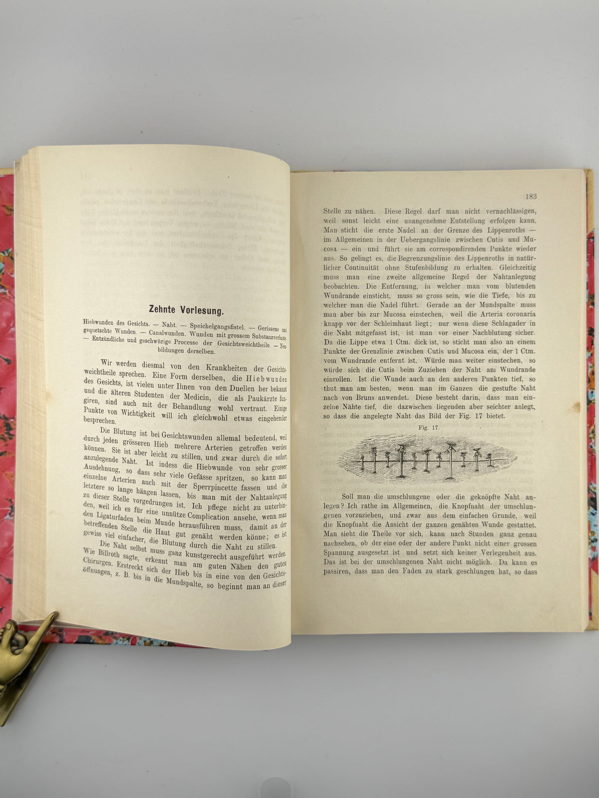 Альберт Едуард. Lehrbuch der Chirurgie und Operationslehre. Т. 1. Відень, 1877