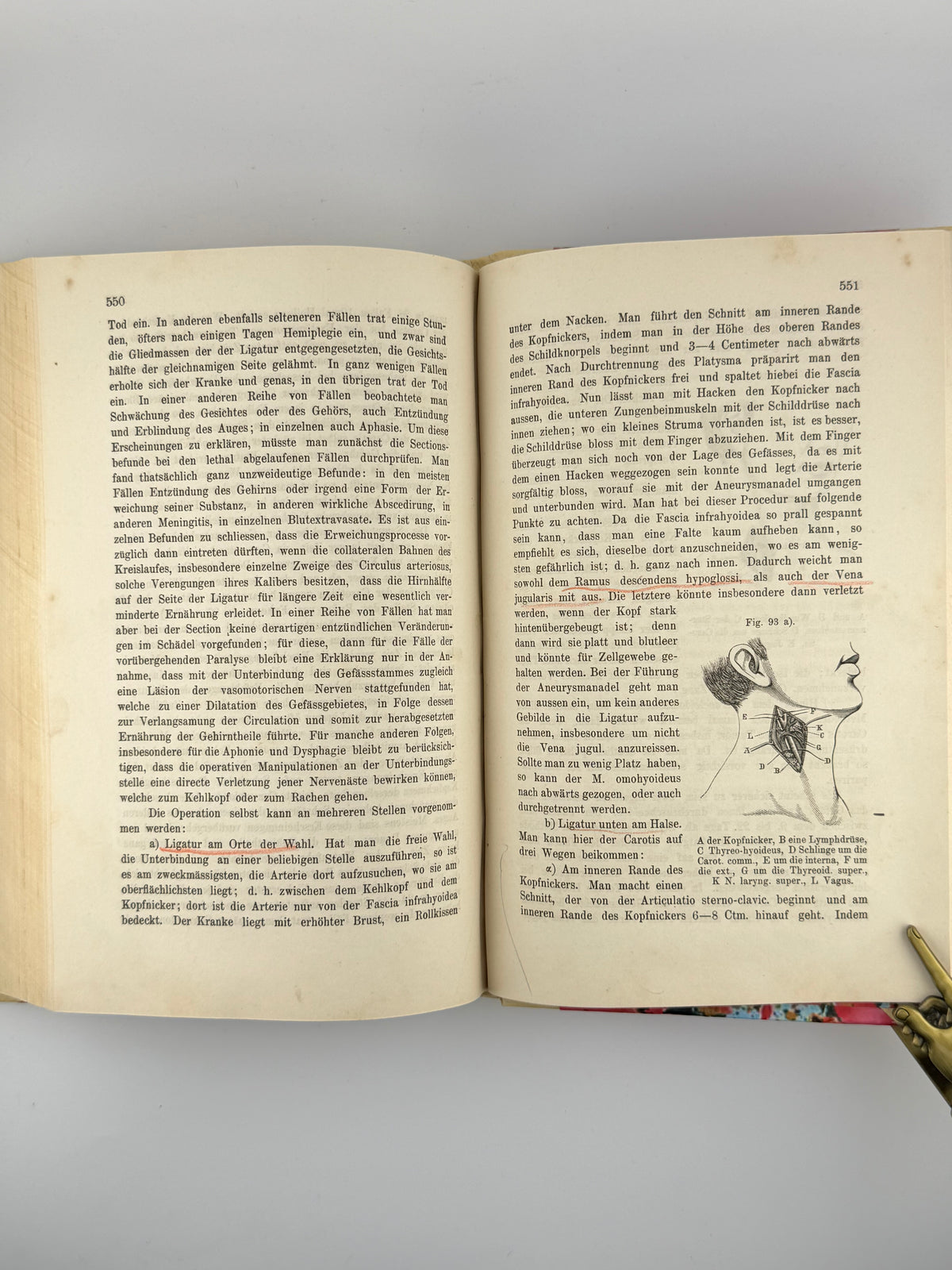 Альберт Едуард. Lehrbuch der Chirurgie und Operationslehre. Т. 1. Відень, 1877