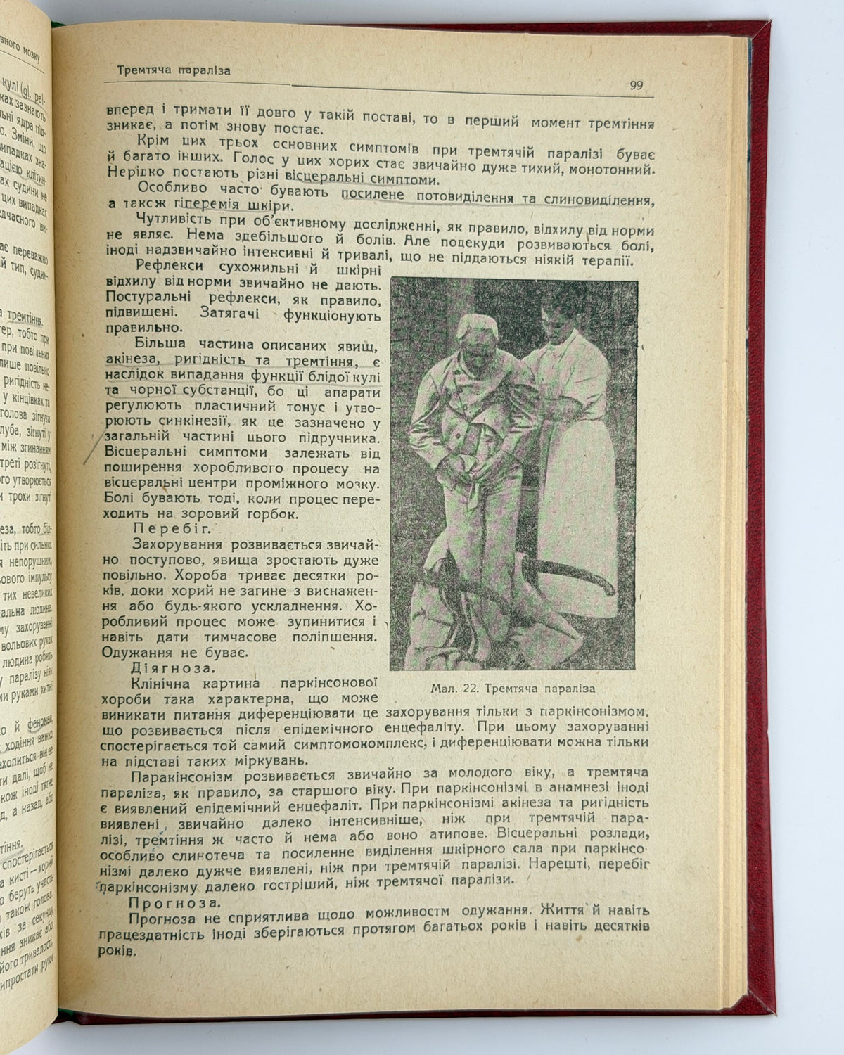 Ґрінштейн О. М. Нервові хороби. [Харків]: Медвидав, 1932 — фото примірника